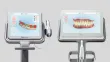 Itero Intraoral Scanner